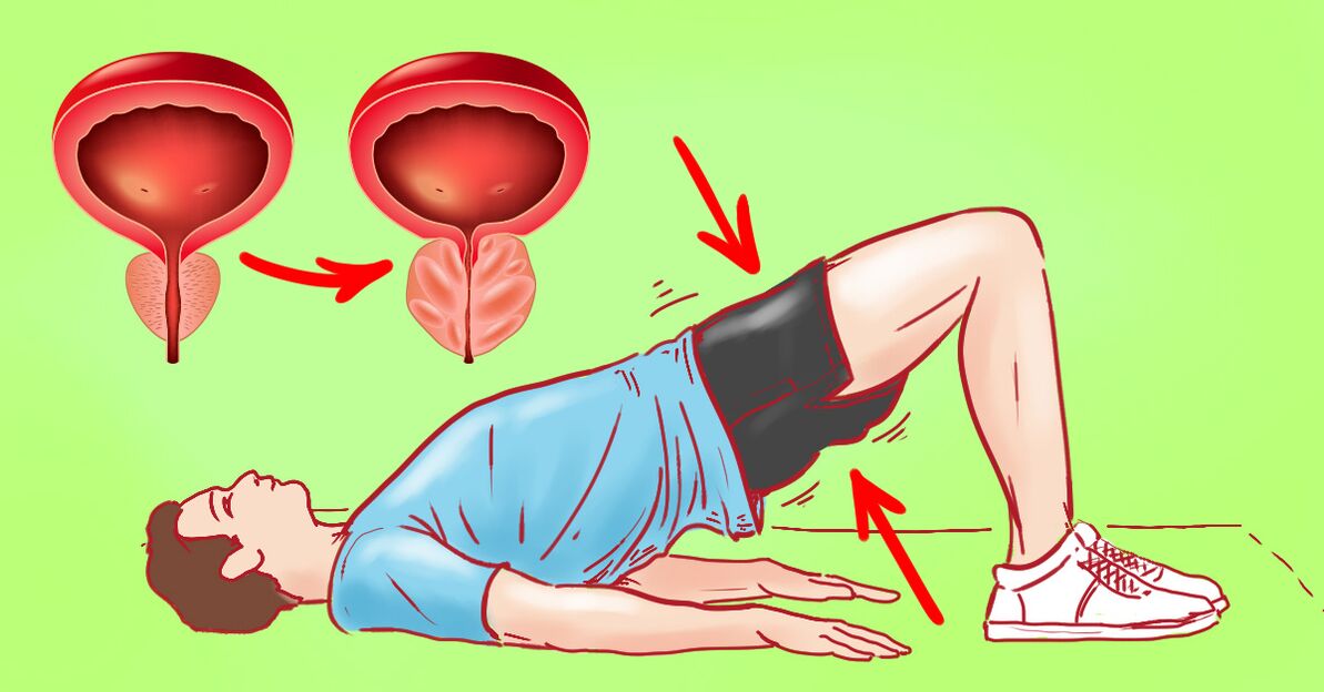 Prostatiidi harjutuste olemus