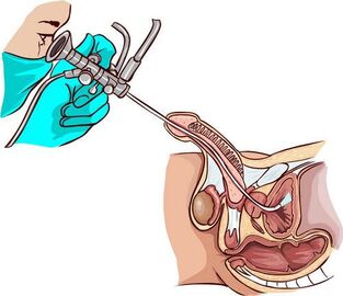 Ureteroskoopia protseduur